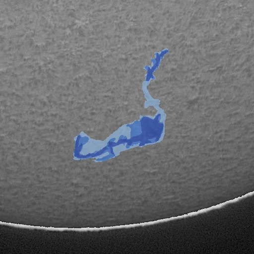 One filament colored by annotator agreement: dark blue unanimous, mid blue two of three, light blue one of three