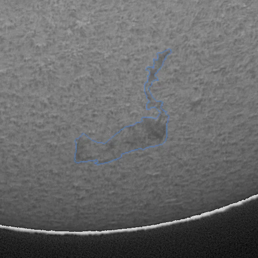 512px native-resolution crop of one filament with its expert outline